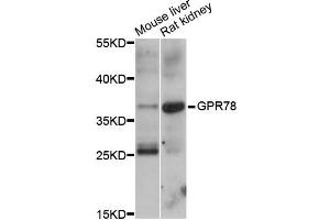 Western blot analysis of extracts of various cell lines, using GPR78 antibody (ABIN5997834) at 1/1000 dilution. (GPR78 antibody)