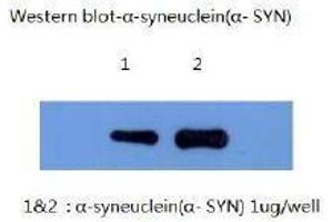 Western Blotting (WB) image for anti-Synuclein, alpha (SNCA) (AA 1-140) antibody (ABIN1105340) (SNCA antibody  (AA 1-140))
