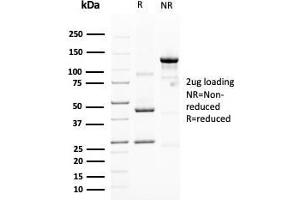 SDS-PAGE Analysis Purified MUC4 Mouse Monoclonal Antibody (MUC4/3105). (MUC4 antibody  (AA 1730-1864))