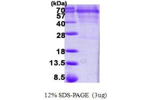 Calcium/calmodulin-Dependent Protein Kinase IV (CAMK4) (AA 1-473) protein (His tag)