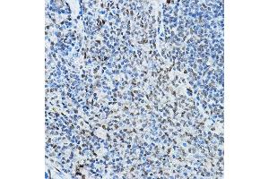 Immunohistochemistry of paraffin-embedded rat spleen using NCOR2 Rabbit pAb (ABIN6130575, ABIN6144422, ABIN6144423 and ABIN6224431) at dilution of 1:100 (40x lens). (NCOR2 antibody  (AA 670-900))