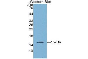 Western Blotting (WB) image for anti-Angiogenic Factor with G Patch and FHA Domains 1 (AGGF1) (AA 406-501) antibody (ABIN1866581) (AGGF1 antibody  (AA 406-501))