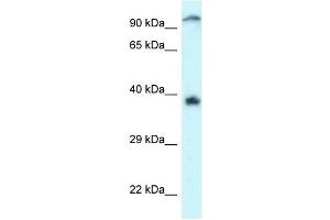 Western Blot showing DOK7 antibody used at a concentration of 1 ug/ml against Jurkat Cell Lysate (DOK7 antibody  (C-Term))