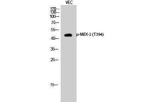 Western Blotting (WB) image for anti-Mitogen-Activated Protein Kinase Kinase 2 (MAP2K2) (pThr394) antibody (ABIN3179468) (MEK2 antibody  (pThr394))