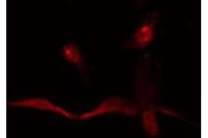 ABIN6275065 staining  HepG2 cells by IF/ICC. (TdT antibody  (Internal Region))