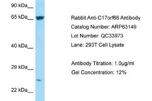 Western Blotting (WB) image for anti-Chromosome 17 Open Reading Frame 66 (C17orf66) (C-Term) antibody (ABIN2789392) (C17orf66 antibody  (C-Term))