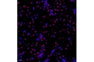 Immunofluorescence of paraffin embedded rat kidney using RB1 (ABIN7075477) at dilution of 1:1400 (400x lens)