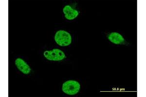 Immunofluorescence of monoclonal antibody to CRKRS on HeLa cell.