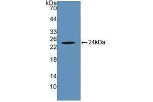 Western blot analysis of recombinant Human VNN1. (VNN1 antibody  (AA 36-223))