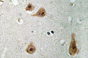 Immunohistochemistry (IHC) analyzes of Annecin I antibody in paraffin-embedded human brain tissue. (Annexin a1 antibody)