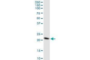 NDUFB10 MaxPab polyclonal antibody. (NDUFB10 antibody  (AA 1-172))