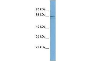 Host:  Rabbit  Target Name:  GALNT9  Sample Type:  HepG2 Whole Cell lysates  Antibody Dilution:  1. (GALNT9 antibody  (C-Term))