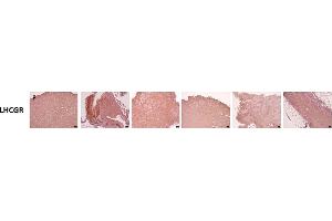 Immunohistochemistry (IHC) image for anti-Luteinizing Hormone/Choriogonadotropin Receptor (LHCGR) (C-Term) antibody (ABIN2857013)