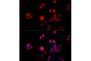 Immunofluorescence analysis of HeLa cells using GLUD2 antibody (ABIN5973969) at dilution of 1/100 (40x lens). (GLUD2 antibody)