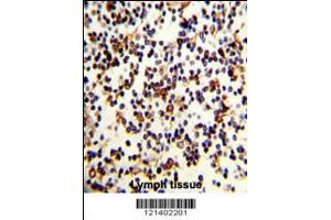 Immunohistochemistry (IHC) image for anti-Complement Component (3d/Epstein Barr Virus) Receptor 2 (CR2) (AA 986-1014), (C-Term) antibody (ABIN5536956)