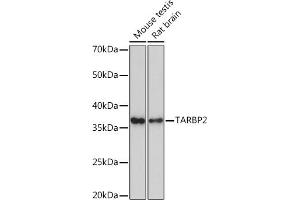 Western blot analysis of extracts of various cell lines, using T Rabbit mAb (ABIN7270729) at 1:1000 dilution.