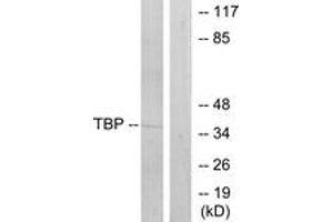 Western blot analysis of extracts from 293 cells, using TBP Antibody.