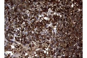 Image no. 2 for anti-Non-Metastatic Cells 1, Protein (NM23A) Expressed in (NME1) antibody (ABIN1499754) (NME1 antibody)