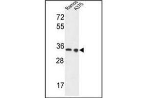 Western blot analysis of LDHA Antibody (Center) in Ramos, A375 cell line lysates (35ug/lane). (Lactate Dehydrogenase A antibody  (Middle Region))