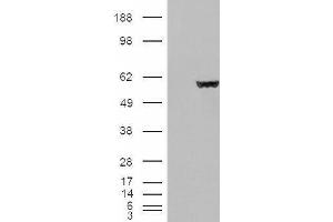 HEK293 overexpressing Fumarase (ABIN5498812) and probed with ABIN190758 (mock transfection in first lane). (FH antibody  (Internal Region))
