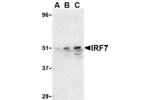Image no. 1 for anti-Interferon Regulatory Factor 7 (IRF7) (C-Term) antibody (ABIN265129) (IRF7 antibody  (C-Term))