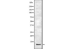 Western blot analysis of CCL23 expression in HEK293 cells ,The lane on the left is treated with the antigen-specific peptide. (CCL23 antibody)