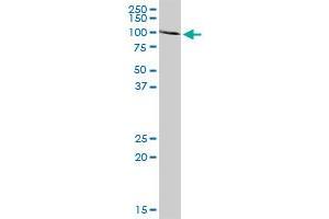 ACO1 MaxPab rabbit polyclonal antibody. (Aconitase 1 antibody  (AA 1-889))