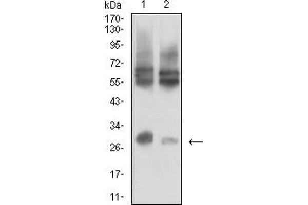 IL15RA antibody  (AA 31-205)