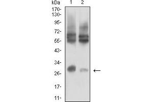 Western blot analysis using CD215 mouse mAb against LOVO (1) and HCT116 (2) cell lysate. (IL15RA antibody  (AA 31-205))