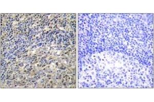 Immunohistochemistry analysis of paraffin-embedded human tonsil tissue, using p47 phox (Ab-370) Antibody. (NCF1 antibody  (AA 341-390))