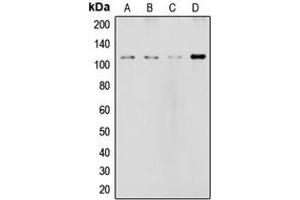 Western blot analysis of NOTCH2 expression in HeLa (A), MCF7 (B), rat liver (C), NIH3T3 (D) whole cell lysates. (NOTCH2 antibody  (Center))