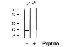 Western blot analysis of extracts of HeLa cells, using ASRGL1 antibody.