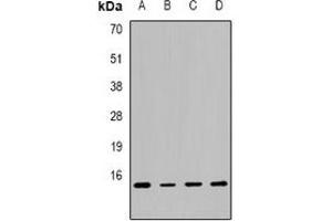 Western blot analysis of Calcitonin expression in MCF7 (A), SW480 (B), mouse lung (C), mouse liver (D) whole cell lysates.
