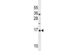 CDKN2A antibody western blot analysis in MDA-MB453 lysate. (CDKN2A antibody  (AA 1-30))