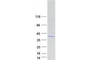 Coiled-Coil Domain Containing 34 (CCDC34) (Transcript Variant 2) protein (Myc-DYKDDDDK Tag)