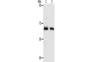 Gel: 8 % SDS-PAGE, Lysate: 40 μg, Lane 1-2: Human fetal kidney tissue, Human fetal lung tissue, Primary antibody: ABIN7128162(ACOT11 Antibody) at dilution 1/450, Secondary antibody: Goat anti rabbit IgG at 1/8000 dilution, Exposure time: 90 seconds (ACOT11 antibody)