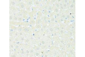 Immunohistochemistry of paraffin-embedded Rat liver using TRIM15 Polyclonal Antibody at dilution of 1:100 (40x lens). (TRIM15 antibody)