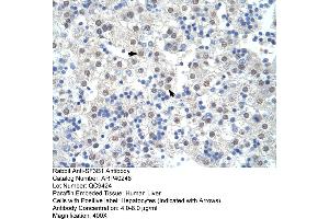 Rabbit Anti-SF3B1 Antibody  Paraffin Embedded Tissue: Human Liver Cellular Data: Hepatocytes Antibody Concentration: 4. (SF3B1 antibody  (Middle Region))