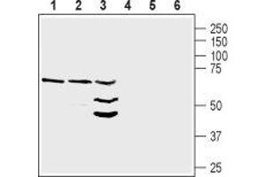 Western Blotting (WB) image for anti-Neuregulin 1 (NRG1) (AA 87-101), (Extracellular) antibody (ABIN7043353)