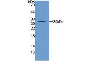 Detection of Recombinant CHRNb2, Human using Polyclonal Antibody to Cholinergic Receptor, Nicotinic, Beta 2 (CHRNb2) (CHRNB2 antibody  (AA 86-244))
