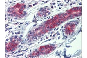 Human Breast: Formalin-Fixed, Paraffin-Embedded (FFPE) (YES1 antibody)