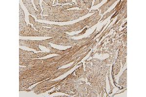 IHC analysis of LPP using anti-LPP antibody (ABIN7599606). (LPP antibody  (AA 10-572))