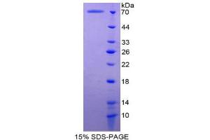 SDS-PAGE (SDS) image for Inhibin, beta B (INHBB) (AA 50-404) protein (His tag,GST tag) (ABIN2123007)