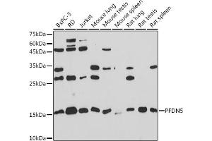 Western blot analysis of extracts of various cell lines, using PFDN5 Rabbit mAb (ABIN1682853, ABIN3018535, ABIN3018536 and ABIN7101624) at 1:1000 dilution. (PFDN5 antibody)