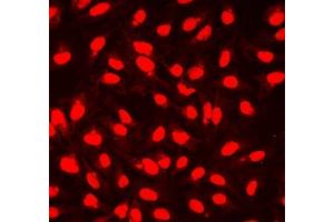 IF analysis of NHEJ1 using anti-NHEJ1 antibody (ABIN7599198). (NHEJ1 antibody  (AA 1-273))