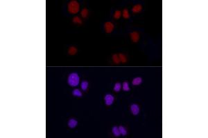 Immunofluorescence analysis of NCI-H460 using Brachyury Rabbit mAb (ABIN1682626, ABIN3019362, ABIN3019363 and ABIN7101757) at dilution of 1:100 (40x lens). (Scinderin antibody)