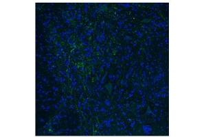 Immunofluorescence -- Dilution: 1. (HTR3E antibody  (Middle Region))