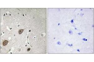 Immunohistochemistry analysis of paraffin-embedded human brain tissue, using BEGIN Antibody. (BEGAIN antibody  (AA 511-560))