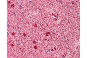 Anti-DCX / Doublecortin antibody IHC staining of human brain, cortex. (Doublecortin antibody)