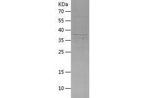 Nuclear Mitotic Apparatus Protein 1 (NUMA1) (AA 1767-2093) protein (His tag)